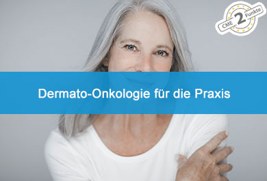 Dermato-Onkologie für die Praxis