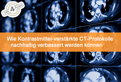 Wie Kontrastmittel-verstärkte CT-Protokolle nachhaltig verbessert werden können