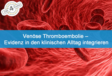 Venöse Thromboembolie – Evidenz in den klinischen Alltag integrieren