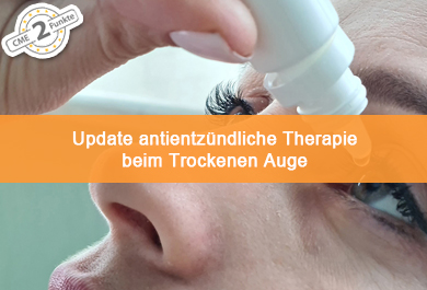 Update antientzündliche Therapie beim Trockenen Auge – Erfahrungen aus der klinischen Praxis